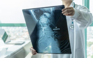 What Types of Damages Are Available to Car Accident Victims?