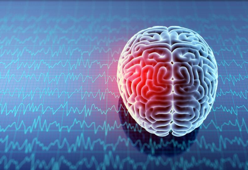 What Is a Coup Contrecoup Brain Injury?